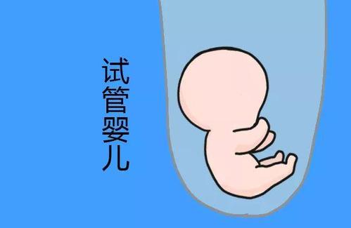 生殖内分泌专家